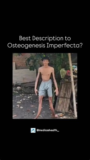 Medical & Health ⚕️ on Instagram: "Diagnose the Condition! 🥼🩺 . . . #viral #explore #medical #reel #education #doctor #medicalstudent #student #biology #study #science #knowledge #mbbsstudent #mbbs #medicalfacts #knowledge #didyouknow #medicalquestions #intrestingfacts #nurse #learning #hospital #treatment #medicine #humanbody #diagnosis #qns #neurology #anatomy #muscle #osteogenesisimperfecta"