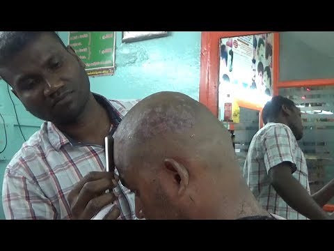 AMAZING AND WEIRD DANDRUFF HEAD SHAVE /How to a Dandruff head shave/ CS ASMR,,