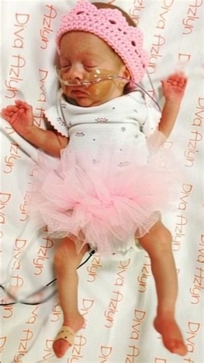 My Preemie 20 Weeks Baby Life Journey😢 #prematurebaby #baby #newbornbaby #preemiebaby #20weeksbaby