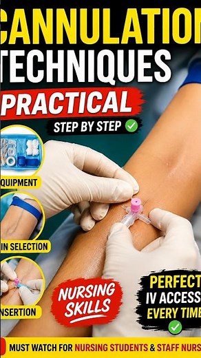 Cannulation Techniques Explained | IV Cannula Insertion Step by Step | Nursing Skills & Tips #shorts