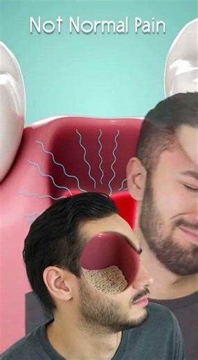 🦷 Dry Socket Pain — When Pain Isn’t Normal