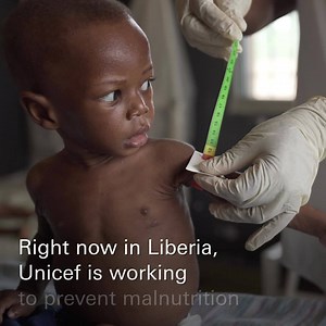 43 reactions · 11 shares | Will you help feed a child’s future? | UNICEF UK | Facebook