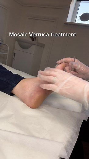 NorfolkEarandFootclinic on TikTok