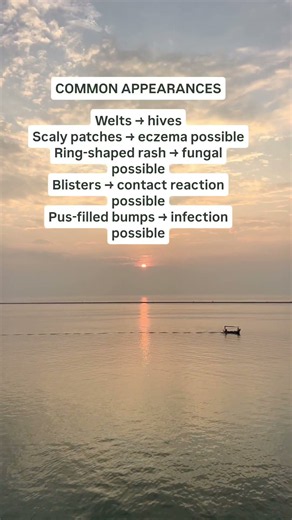 How do I identify different types of skin rashes? #theimmunecity #health #skinimmunity #skinspots