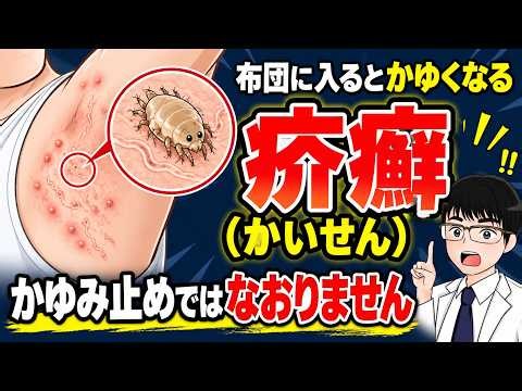Symptoms, Identification, and Treatment of Scabies: Why Your Anti-Itch Cream Might Be Doing More ...