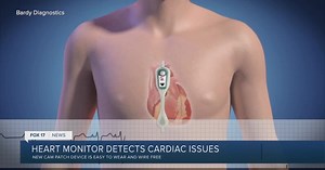 New heart monitor technology detects cardiac issues