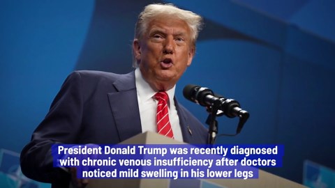 Trump's diagnosis: what is chronic venous insufficiency?