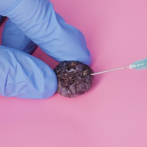 47K views · 63 reactions | Inside the Operating Room: Step-by-Step Surgical Procedures | Wood Mood | Facebook