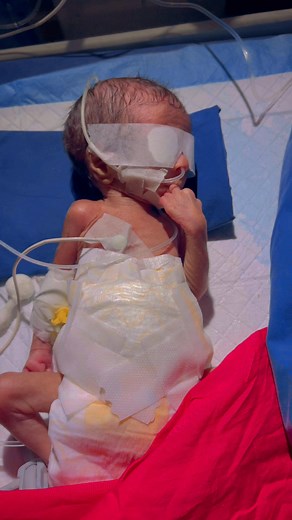 2M views · 84K reactions | baby sucking reflex..爐 #fypシ゚ #baby #cute #babysleep #Premature #viralreelsシ #babyfeeding #feed #lovestory #motherlylove #FamilyDrama #funnymoments #personalgrowth #relationships | শিশুর যত্ন এবং স্বাস্থ্য পরামর্শ | Facebook