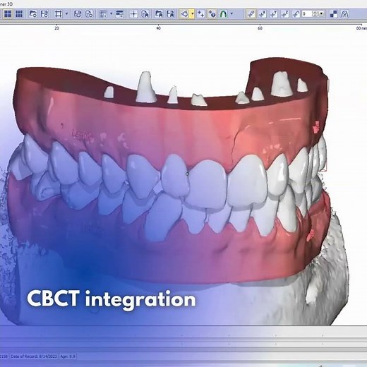 Onyxceph Training | With Dr. Raul Mora Onyxceph official Trainer