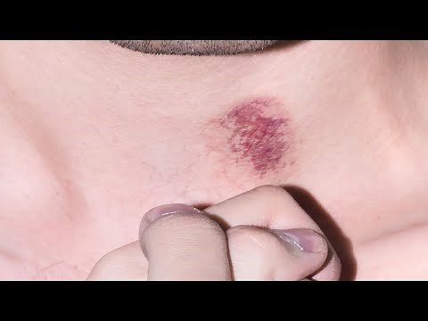 how to give a love bite on neck step by step tutorial