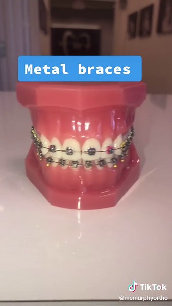 Ceramic Braces vs. Invisalign: Making the Right Choice