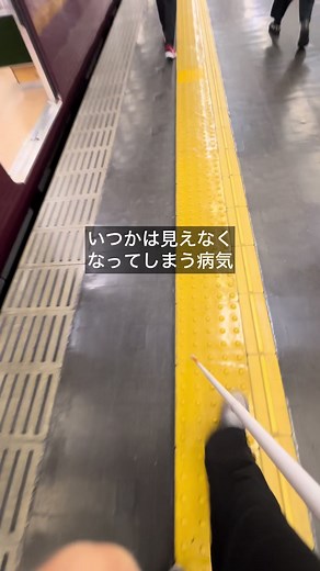 緑内障とその影響についての理解