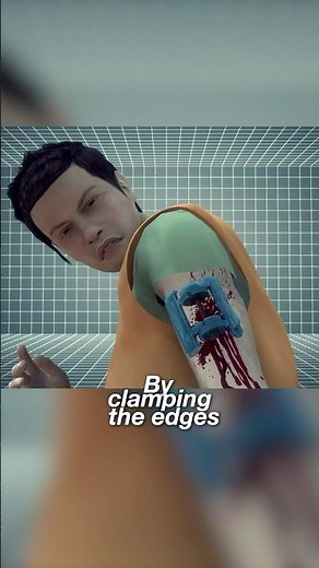 Stop Bleeding Wound In Seconds