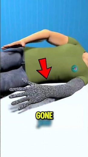 What Happens If You Sleep on Your Arm Too Long? 😳