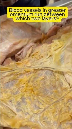 Blood vessels in greater omentum run between which two layers of peritoneum? #shortsindia