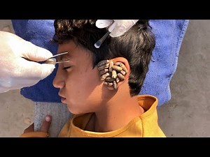 ASMR Gentle Ear Attention | No Talking