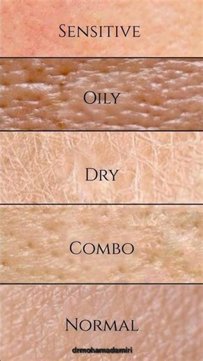 “Know Your Skin Type: The Key to Healthy Skin”
