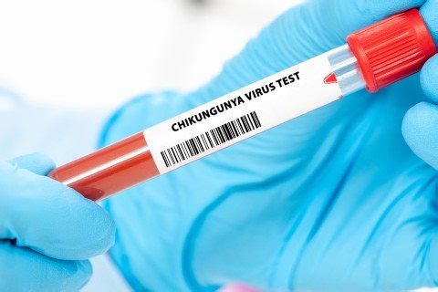 NICD reports 10 travel-related cases of Chikungunya virus
