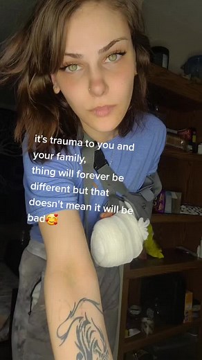 Overcoming Trauma and Amputation: A Journey to Healing