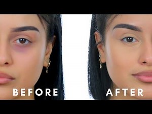 STOP AUX CERNES : MA NOUVELLE TECHNIQUE !