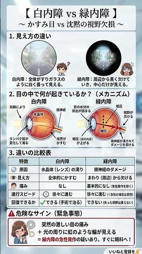 【目の寿命】白内障と緑内障の違いを徹底解剖！かすみ目vs沈黙の視野欠損｜放置すると怖い「見え方の異変」と手遅れになる前のセルフチェック