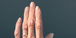 Treatments to make hands look younger: Is there such a thing as a hand lift?
