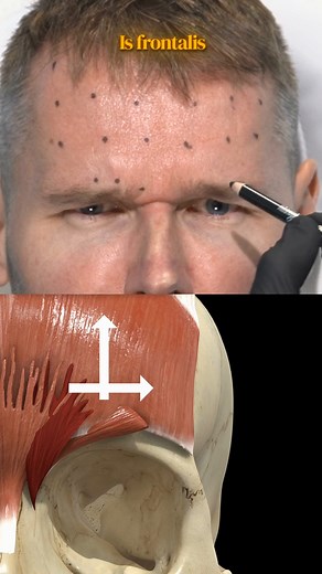 37K views · 197 reactions | The corrugator and frontalis muscles are...