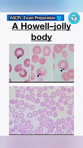 🌐ASCP_Preparation: #highlightsシ゚ #fypシ #highlights #highlightseveryone #reelsviralシ #viralreelschallenge | Medical Laboratory Scientists