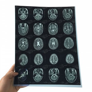 [Hot Item] Agfa Drystar 5300 Direct Digital Laser Image Radiography X-ray Film