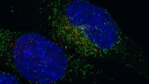 Gene Fusion Shifts Cell Activity into High Gear, Causing Some Cancer