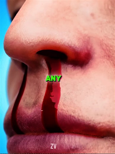 Why Do Nose Bleeds Happen_ 🤔#zackdfilms #animation #educational #didyouknow