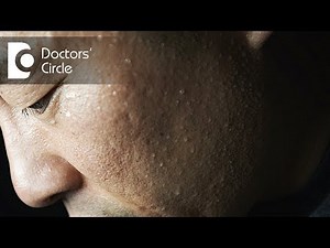 What causes night sweats during normal weather in young men? - Dr. Suresh G