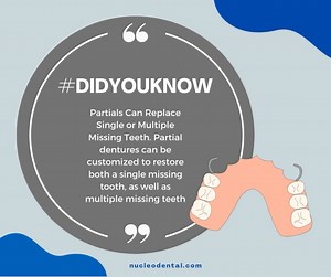 Partials can be installed within a short period, eliminating the need to wait for months with a missing tooth. . Phone: 915 308 0101 nucleodental.com . #NucleoDental #ElPasoTx #CiudadJuarez #NewMexico #dentalclinicnearme #oralcare #oralhealth #dentaltourism #dentaltourismmexico #dentalimplantsmexico #dentalimplantsjuarez #bestdentalserviceintown #cosmeticdentistry #dentalservice #orthodonticservice #fullmouthrehabilitation #americaninsurance #transportationservice #dentalimplants #dentalservicec