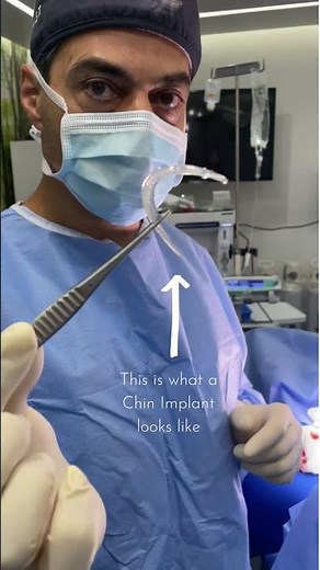 What Does A Chin Implant Look Like?