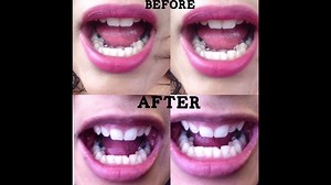 @iisabel_v's Carbon Coco review #CarbonCocoResults 🖤 www.carboncoco.com | Carbon Coco