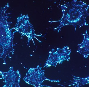 A Light Switch for Turning Proteins On & Off | Cell And Molecular Biology