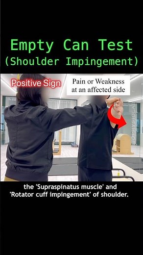 Empty Can Test. Jobe Test. #rotatorcuffinjury #supraspinatus #shoulderimpingement #shoulderinjury