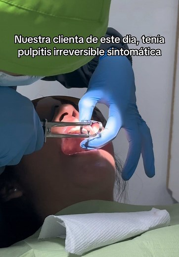 Endodoncia con Pulpitis Irreversible en Odontoplus