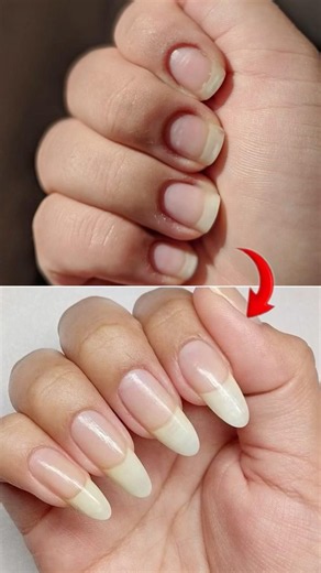 This actually worked 😳⚠️How to grow your Nails in just 2 Days / How to Grow Nails fast /