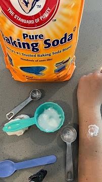 Mosquito Bite / Chigger Bites Itch Relief Homemade Paste - DIY - Cheap to make Works for me