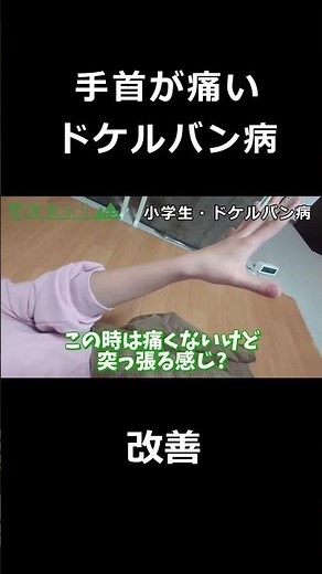 【厚木市・本厚木の整体】ドケルバン病（腱鞘炎）→改善したビフォーアフター