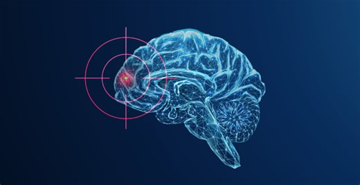 Magnetizing the Mind: Exploring Transcranial Magnetic Stimulation