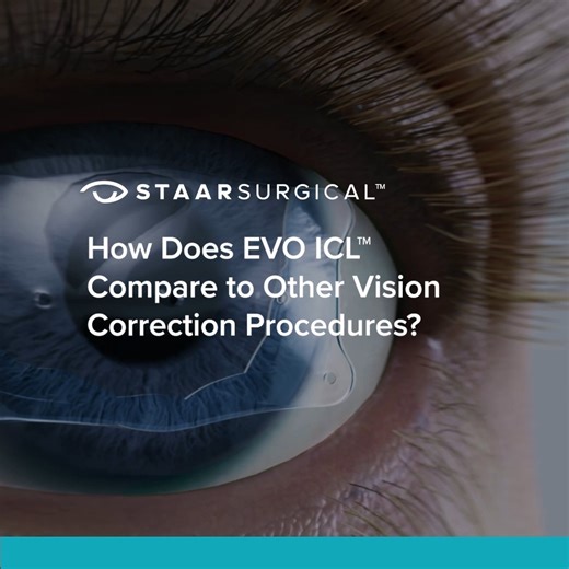STAAR Surgical on Instagram: "EVO ICL™ is transforming vision correction—outpacing laser vision correction and growing double digits in just two years. Why? EVO ICL offers a lens-based solution with unique features, including: ✔️ Reversibility ✔️ Flexibility to accommodate future procedures ✔️ Built-in UV protection ✔️ Preservation of corneal tissue—no tissue is removed Discover why EVO ICL is revolutionizing vision correction. Learn more at EVO.STAAR.com. #STAAR #EVO #ophthalmology #ophthalmolo