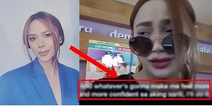 Arci Muñoz Finally Breaks Silence Over "Cosmetic Surgery" Allegation