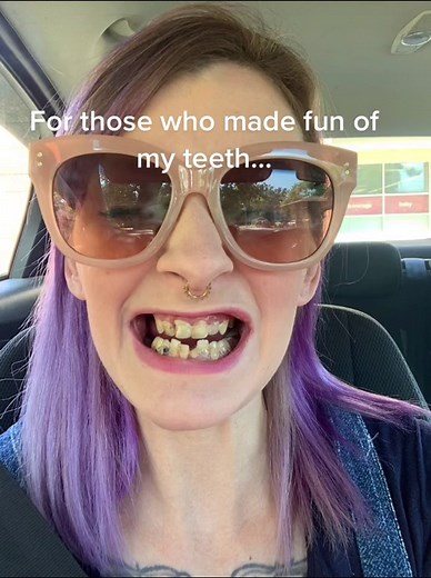 The Power of Dentures: Embracing Confidence and Comfort