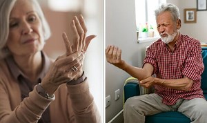 Rheumatoid Arthritis: NHS on common signs and symptoms