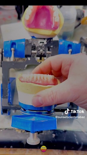 Duplicate Dentures Wax Setup on Panadent #sunsetdentallabaz #panadent #denture #dentures #dentaltech #dentaltechnician #dentaltechnology #dentallab #dentallaboratory #dental #dentist #dentistsoftiktok #dentalvibes #smile #insidelook #wax #waxart #dentalart #howto #tucson #tucsonarizona #tucsondentists #tucsondentist #smallbusiness #arizonasmallbusiness #businessowner #PepsiApplePieChallenge