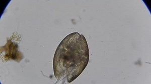 clip-11555774-ostracod-crustacean-under-microscope-40x