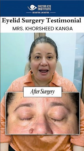 Patient Story: Quick & Safe Removal of Eyelid Skin Tags